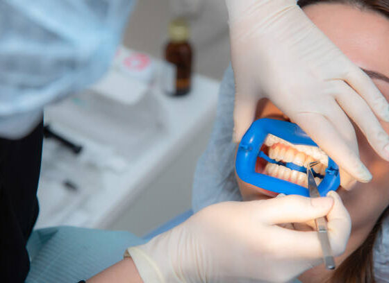 Best Dental Clinic in Bangalore